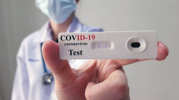 Llegan los autotest de coronavirus a las farmacias para su venta al público