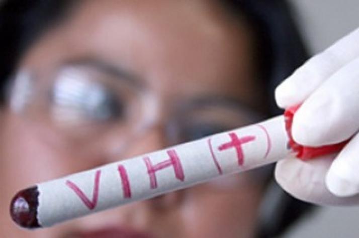 El ritmo de contagios de VIH cayó 35% en 15 años 